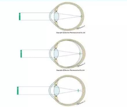 QQ截图20170208154242.jpg QQ截图20170208154242.jpg