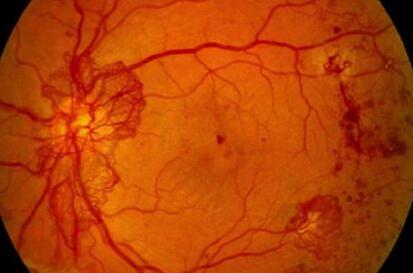 QQ截图20171117115908.jpg QQ截图20171117115908.jpg