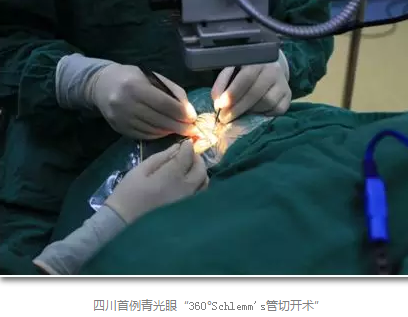 成都太阳成tyc7111cc已经开展的青光眼手术有:引流阀 (钉)植入手术(2015年以来已200多 ),360°Schlemm's管切开术,激光CO2 辅助巩膜深层切除术,小梁切除术青(光眼)白(内障)联合手术。还有虹膜周切术、前房成形术、 虹膜复位术,睫状体冷冻术,小梁切开术和前房穿刺术等6.png 成都太阳成tyc7111cc已经开展的青光眼手术有:引流阀 (钉)植入手术(2015年以来已200多 ),360°Schlemm's管切开术,激光CO2 辅助巩膜深层切除术,小梁切除术青(光眼)白(内障)联合手术。还有虹膜周切术、前房成形术、 虹膜复位术,睫状体冷冻术,小梁切开术和前房穿刺术等6.png