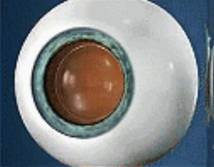 升学、征兵、公务员、就业，对于近视朋友而言，这些总是拦路虎……如今有多种近视 方法，想要摘镜，总有一款适合您.jpg