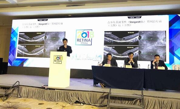 3月28日,为期4天的中国眼底病领域一年一度的学术年会“2018中国眼底病论坛暨环球视网膜研讨会”(RetinaChina 2018)在中国青岛召开。本次论坛由中国环球科技交流中心主办,《中华眼底病杂志》协办,会上翘楚云集,盛况空前,既是眼底病学诊疗领域的高水平年度学术盛会,也是世界眼底专家的一*次交流盛会4.jpg 3月28日,为期4天的中国眼底病领域一年一度的学术年会“2018中国眼底病论坛暨环球视网膜研讨会”(RetinaChina 2018)在中国青岛召开。本次论坛由中国环球科技交流中心主办,《中华眼底病杂志》协办,会上翘楚云集,盛况空前,既是眼底病学诊疗领域的高水平年度学术盛会,也是世界眼底专家的一*次交流盛会4.jpg