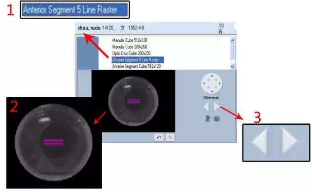 太阳成tyc7111cc课堂:后节频域OCT前节模块的运用1.jpg 太阳成tyc7111cc课堂:后节频域OCT前节模块的运用1.jpg