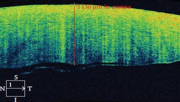 太阳成tyc7111cc课堂:后节频域OCT前节模块的运用3.jpg 太阳成tyc7111cc课堂:后节频域OCT前节模块的运用3.jpg