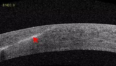 太阳成tyc7111cc课堂:后节频域OCT前节模块的运用4.jpg 太阳成tyc7111cc课堂:后节频域OCT前节模块的运用4.jpg