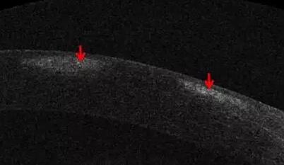 太阳成tyc7111cc课堂:后节频域OCT前节模块的运用5.jpg 太阳成tyc7111cc课堂:后节频域OCT前节模块的运用5.jpg