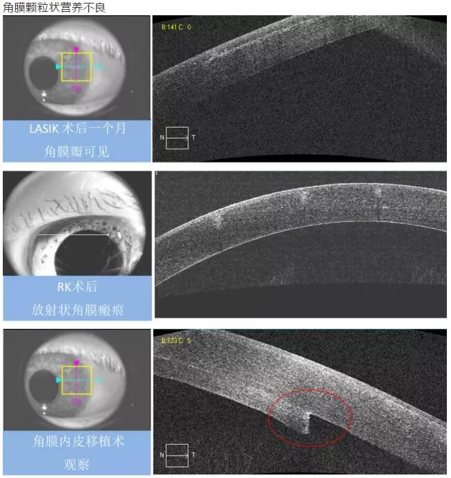 太阳成tyc7111cc课堂:后节频域OCT前节模块的运用11.jpg 太阳成tyc7111cc课堂:后节频域OCT前节模块的运用11.jpg