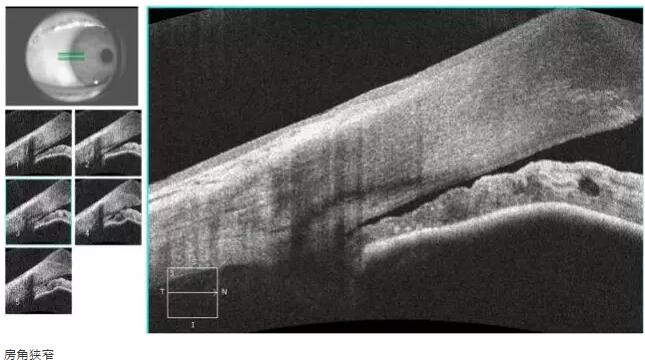 太阳成tyc7111cc课堂:后节频域OCT前节模块的运用13.jpg 太阳成tyc7111cc课堂:后节频域OCT前节模块的运用13.jpg