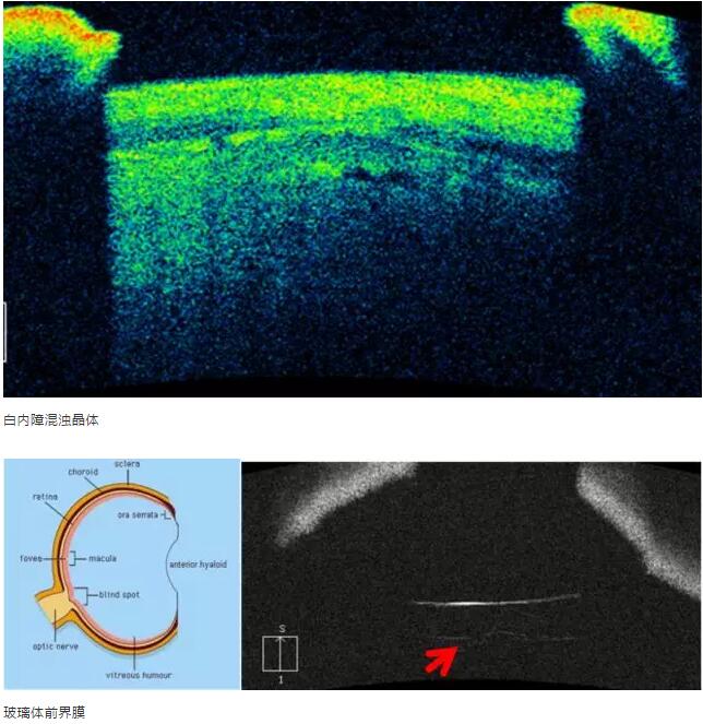 太阳成tyc7111cc课堂:后节频域OCT前节模块的运用14.jpg 太阳成tyc7111cc课堂:后节频域OCT前节模块的运用14.jpg