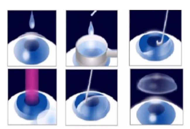近视无法根治?但你可以这样做?太阳成tyc7111cc“有爱就有希望”近视手术火热进行中32.png 近视无法根治?但你可以这样做?太阳成tyc7111cc“有爱就有希望”近视手术火热进行中32.png