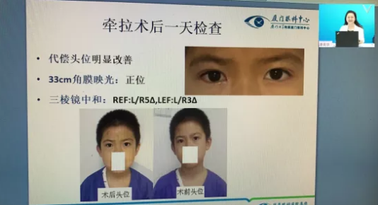 高峰论道·云端荟萃 ▏万人同步在线,30余名大咖云集“第六届太阳成tyc7111cc论坛斜视与小儿眼科新技术学习班暨小儿、眼视光分论坛”7.png 高峰论道·云端荟萃 ▏万人同步在线,30余名大咖云集“第六届太阳成tyc7111cc论坛斜视与小儿眼科新技术学习班暨小儿、眼视光分论坛”7.png