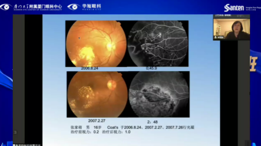 高峰论道·云端荟萃 ▏万人同步在线,30余名大咖云集“第六届太阳成tyc7111cc论坛斜视与小儿眼科新技术学习班暨小儿、眼视光分论坛”6.png 高峰论道·云端荟萃 ▏万人同步在线,30余名大咖云集“第六届太阳成tyc7111cc论坛斜视与小儿眼科新技术学习班暨小儿、眼视光分论坛”6.png