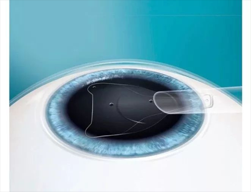 ICL (7).png ICL (7).png